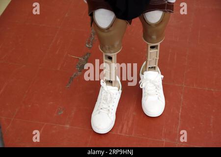 (190407) -- SANAA, April 7, 2019 -- A landmine victim stands as he tries prosthetic limbs at a rehabilitation center in Sanaa, Yemen, on April 7, 2019. Large swathes of Yemen have been swamped by randomly-planted landmines, which are posing a lingering threat to the lives of citizens across the war-torn country. According to the United Nations, thousands of landmines, unexploded ordnance and other explosive war remnants have been left behind during the ongoing conflict in Yemen which has just entered its fifth year. ) YEMEN-SANAA-LANDMINES-VICTIMS MohammedxMohammed PUBLICATIONxNOTxINxCHN Stock Photo