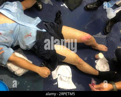 (190905) -- BEIJING, Sept. 5, 2019 -- Photo taken on Aug. 11, 2019 shows an injured Hong Kong police officer in south China s Hong Kong. Xinhua Headlines: Hong Kong police: doxxed, ambushed, yet still resolute WuxXiaochu PUBLICATIONxNOTxINxCHN Stock Photo