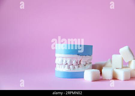 Plaster model of the jaw with sugar cubes on a pink background. Sweets are bad for teeth. Stock Photo