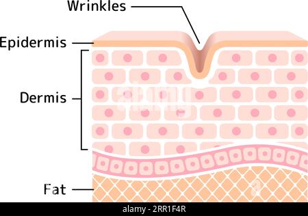 Cross section illustration of wrinkled skin Stock Vector Image & Art ...