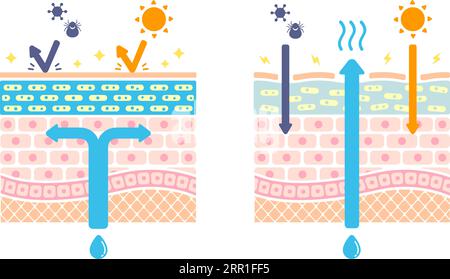 Comparison illustration of healthy skin and dry skin (cross section of skin) Stock Vector