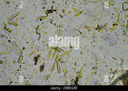 soil life under the microscope with soil fungi and fungal hyphae on a ...