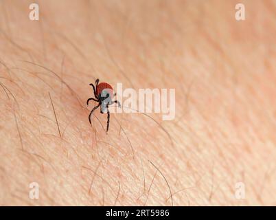 close up of a deer tick on human skin Stock Photo