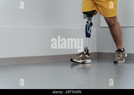 Unrecognisable male in yellow coloured shorts wearing prosthetic leg Stock  Photo - Alamy