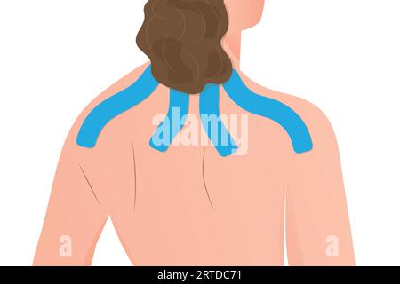 kinesiology taping on woman back- vector illustration Stock Vector