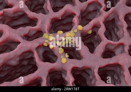 Small cancer tumors on the lung tissue: lung cancer (LC) - isometric view 3d illustration Stock Photo