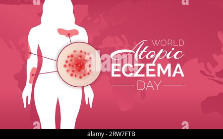 World Atopic Eczema Day Background Illustration Design with People ...
