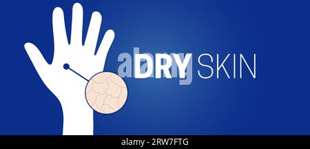 Dry Skin on Hand Background Illustration Design Stock Vector