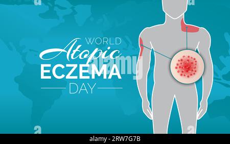 World Atopic Eczema Day Background Illustration Design with a Man Stock Vector