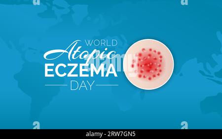 World Atopic Eczema Day Background Illustration Design with People ...