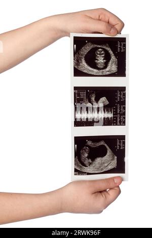 Hands holding ultrasound scans of a baby isolated on white background Stock Photo