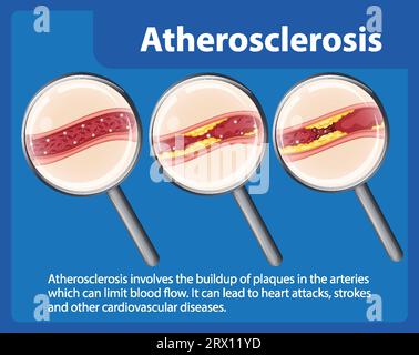 Infographic on heart health and cardiovascular disease risks Stock Vector