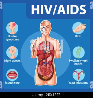 Impact of HIV/AIDS virus on human immune system Stock Vector