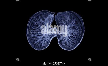 CT Chest or CT lung 3d rendering image with blue color showing Trachea and lung in respiratory system. Stock Photo