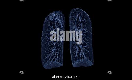CT Chest or CT lung 3d rendering image with blue color showing Trachea and lung in respiratory system. Stock Photo