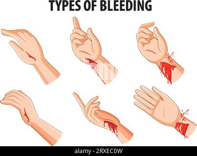 Medical illustration of the various types of human muscle tissue Stock ...