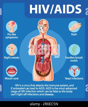 Illustration depicting how HIV/AIDS virus attacks and affects the human body Stock Vector