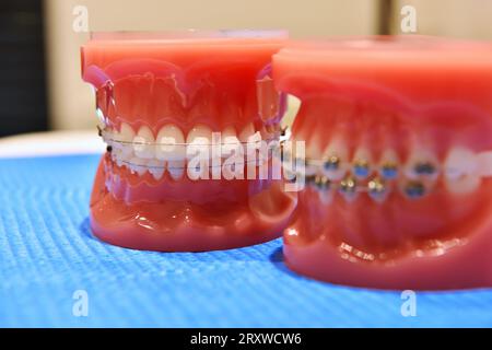 demonstration teeth model of orthodontic braces. close up Stock Photo