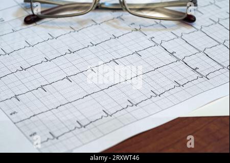 eyeglasses on Electrocardiogram (EKG) heartbeat graph Stock Photo