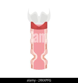 Trachea narrowing awareness icon of tracheal stenosis Stock Vector