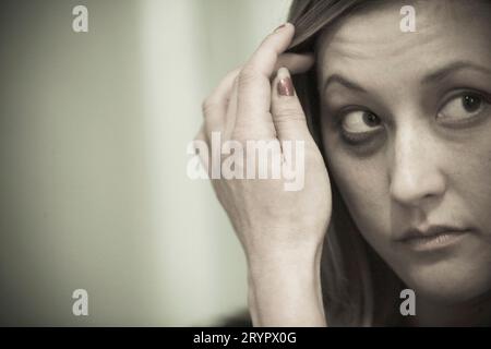 Portrait of a young woman with a black eye. Stock Photo