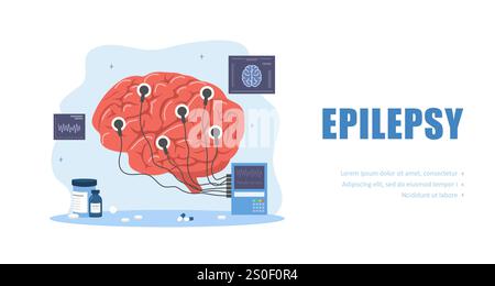 Epilepsy concept. Electroencephalography. Brain Connected to Display with EEG Indication. Vector illustration in flat cartoon style Stock Vector