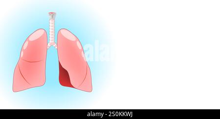 Lungs anatomy. Human respiratory tract with lungs, trachea, larynx on blue and white background with copy space for your text. Vector illustration Stock Vector