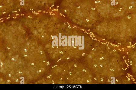 Microscopy image of druses in neem leaf Stock Photo