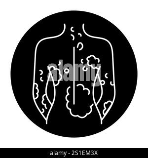 Psoriasis color line icon. Autoimmune diseases. Vector isolated element. Editable stroke. Stock Vector