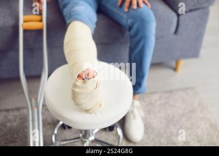 Close Up Of Broken And Bandaged Leg Of Man On Sofa At Home Stock Photo
