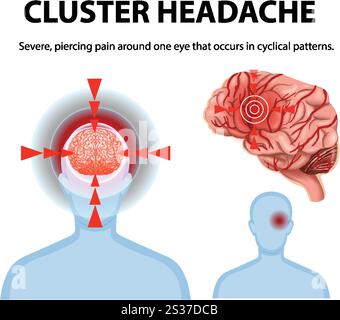 Brain Pain Risactor Illustration of severe headache pain and brain anatomy Stock Vector ...