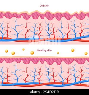 Layer of damaged skin illustration Stock Vector Image & Art - Alamy