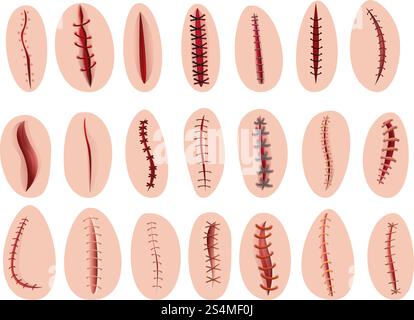 Suture icons set. Cartoon set of suture vector icons for web design. Suture icons set, cartoon style Stock Vector