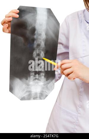 nurse shows X-ray picture with human spinal column isolated on white background Stock Photo