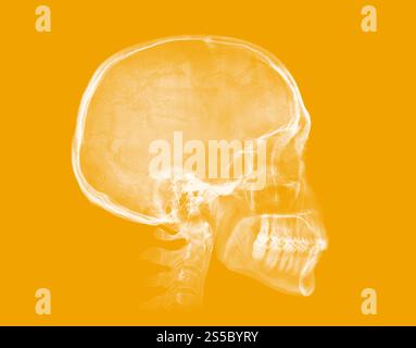 Human skull. X-ray image isolated on yellow background. Human skull. X-ray image on yellow background Stock Photo