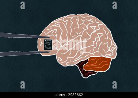An illustration depicting a human brain with tweezers installing a microchip This concept highlights the integration of technology with human cognitio Stock Photo