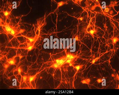 Sprouting connections in the brain: Adding GDF10 to neurons in a dish ...