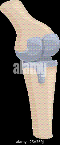 Detailed vector illustration of a human knee joint, showcasing bones ...