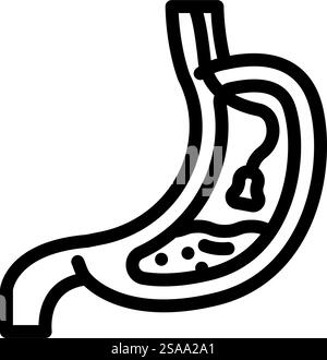 endoscopy surgery line icon vector. endoscopy surgery sign. isolated contour symbol black illustration. endoscopy surgery line icon vector illustration Stock Vector