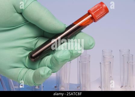 A scientist handling a blood sample in a test tube Stock Photo