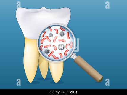 Tooth and a magnifying glass that zooming in to bacteria and microorganisms present on the surface. Tooth decay. Bacterial biofilms and dental disease Stock Vector
