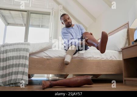 Man with leg prosthesis sitting on bed Stock Photo