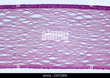 Coloured light micrograph of a healthy human cornea, the transparent part of the front of the eye. Visible from top to bottom are the non-keratinized stratified squamous corneal epithelium, a thin acellular Bowman's layer, the corneal stroma with collagen fibres and interspersed keratocytes, a thick Descemet's membrane and a very thin endothelium. Stained with Giemsa. Magnification: 832x when printed 10 centimetres wide. Stock Photo