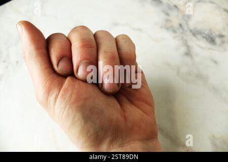 Left male hand with cuts and dirt close-up. Stock Photo