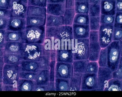 Plant cell mitosis. Light micrograph of root tip cells from an onion ...