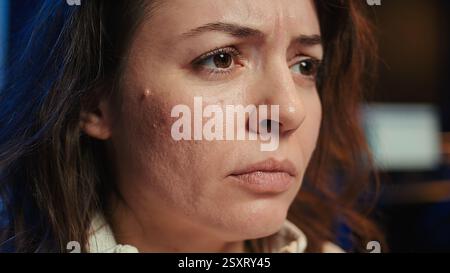 Upset teleworking engineer worried after failing to secure company servers from virus attacks, close up. Anxious woman stressed about being unable to build firewalls protecting data, camera B Stock Photo
