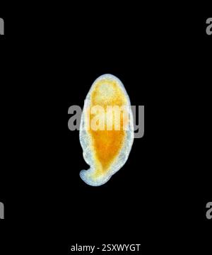 Light micrograph of a flatworm (order Prolecithophora). Specimen collected in Lake Baikal, Russia. Stock Photo