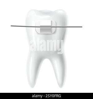 Realistic tooth with braces. White 3d isolated teeth, bite correction in stomatology clinic. Orthodontist treatment brackets isolated. Medicine Stock Vector