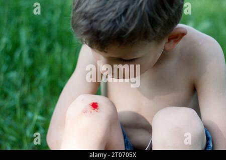 Portrait of preschool boy sitting on grass with fresh bleeding wound on knee. child fell, scratched skin on knee, hurt, upset. Children injuries in su Stock Photo