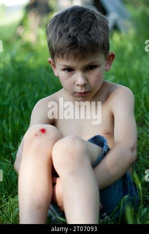 Portrait of preschool boy sitting on grass with fresh bleeding wound on knee. child fell, scratched skin on knee, hurt, upset. Children injuries in su Stock Photo